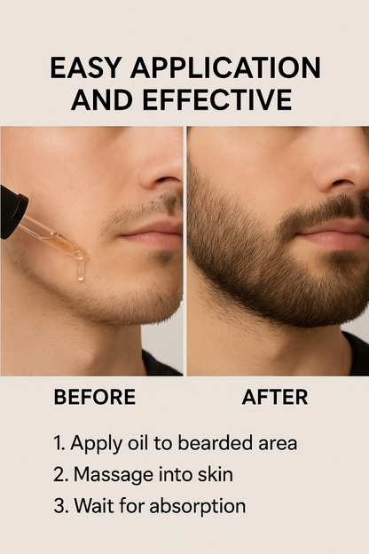 Mens Beard Growth Oil -30ML